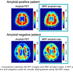 Amyroid PET_Fig.1-2